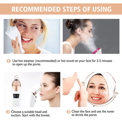 Electric Blackhead Remover Bloom Aura™
